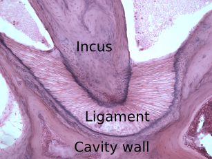 Histological image
showing incus and ligament