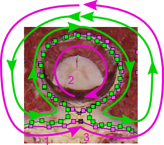 Lines involved in a hole