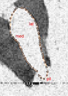 3 lines after splitting