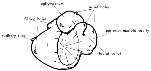 Casting of cavities