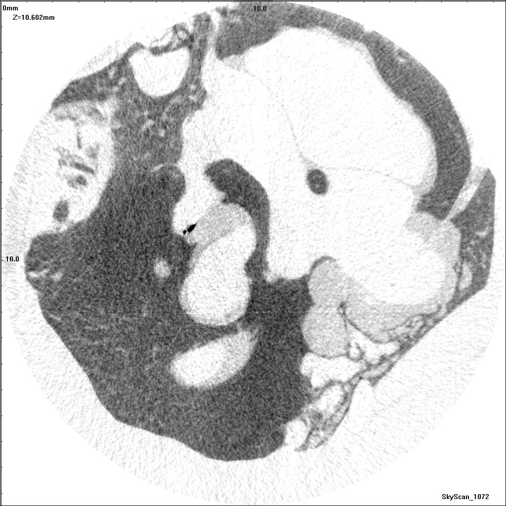 Section with eardrum