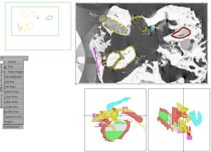 Human MRM segmentation