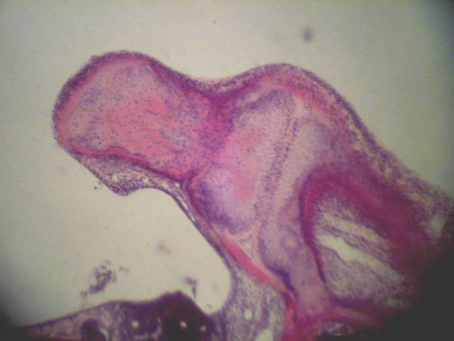 Cat histology: incudostapedial joint