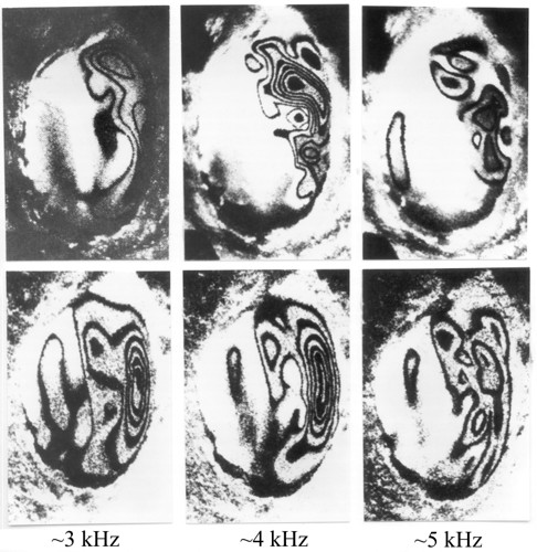 Variability of high-frequency patterns