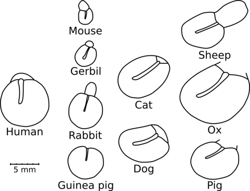 Eardrum configurations 2