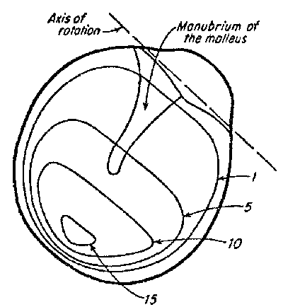 Bekesy low frequency