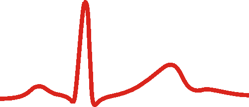 ECG signal