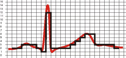 Sampled ECG