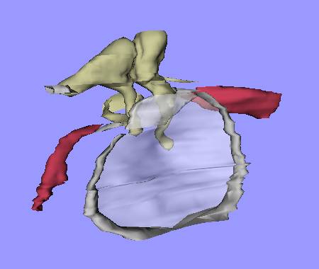 Ossicles, muscles, ligaments and TM (VRML model)